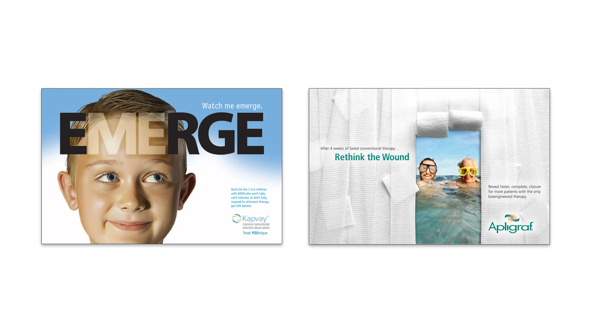 Kapvay Emerge and Apligraf Rethink the Wound